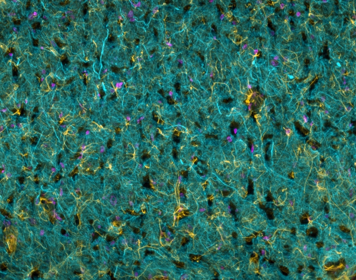 Figure 3: Single optical section of a rat brain slice imaged at 20X using a ZIVA Light Engine coupled to a Yokogawa CSU confocal scanner