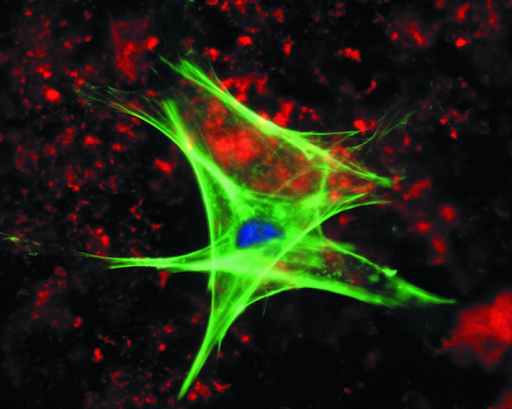 How to optimise fluorescence imaging with linear variable filters (LVFs)