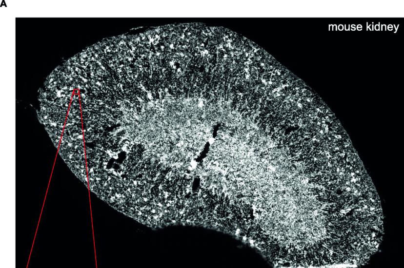 multiplexed error-robust fluorescence in situ hybridisation image of a mouse kidney