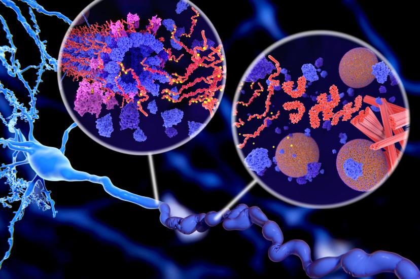 Image of protein aggregation of the pathological Tau protein (red-orange) to neurofibrillary tangles (orange) in a neuron axon in Alzheimer’s disease (Image:Shutterstock/Juan Gaertner)