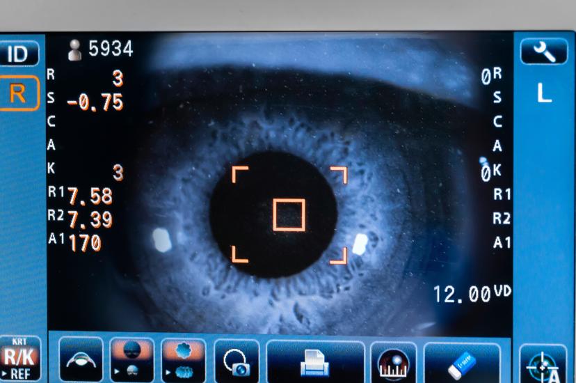 eye imaging