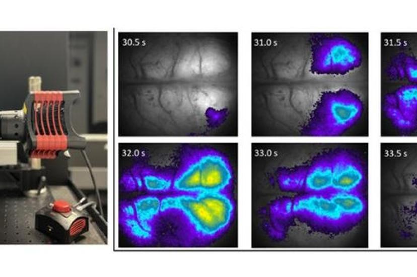 mesoscope low cost brain