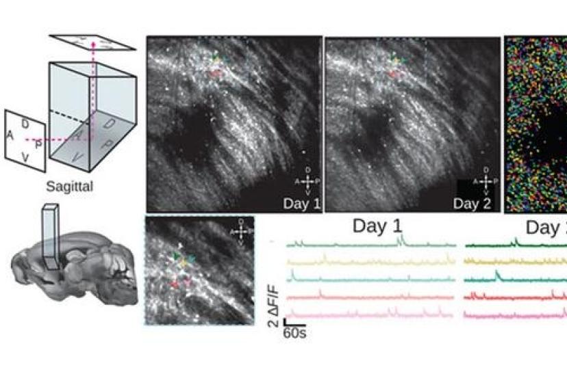 Brain imaging microprism