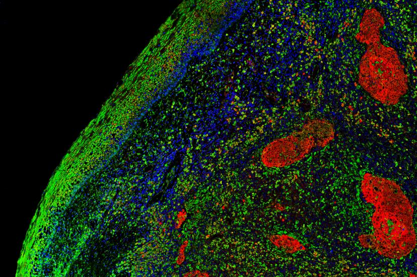 Fluorescence imaging can present a balancing act 