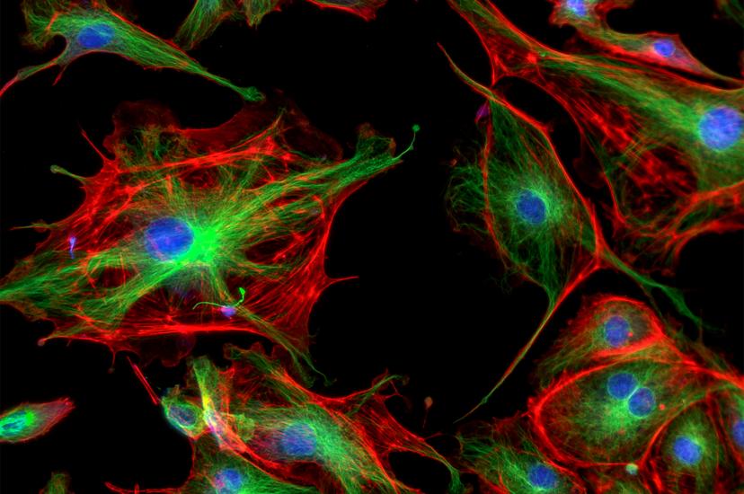 Confocal microscope