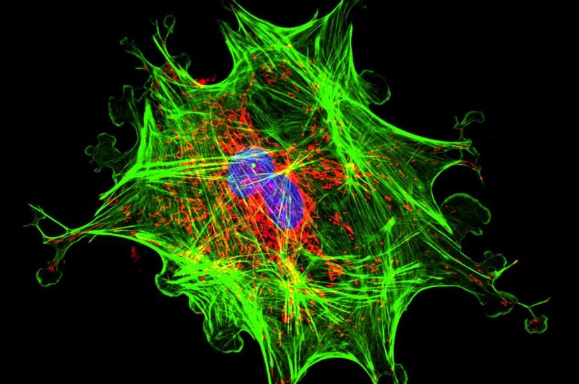 fluorescence lifetime microscopy