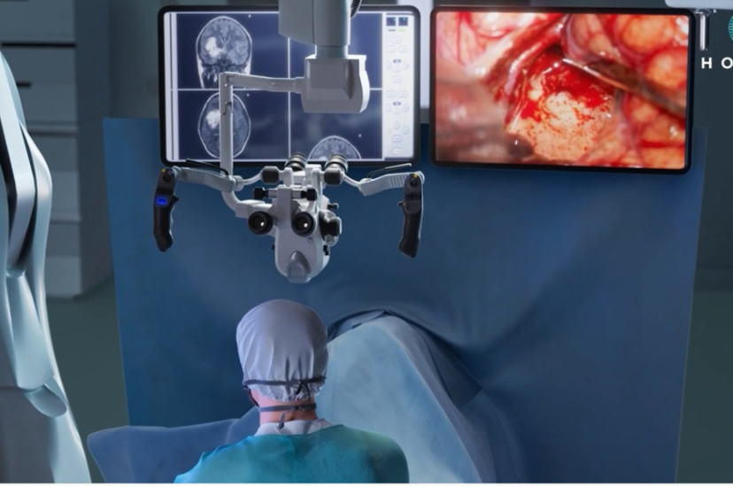 A surgeon, with their back to the camera, is carrying out brain surgery with the assistance of two screens showing polarimetric scans of the patient's brain tissue