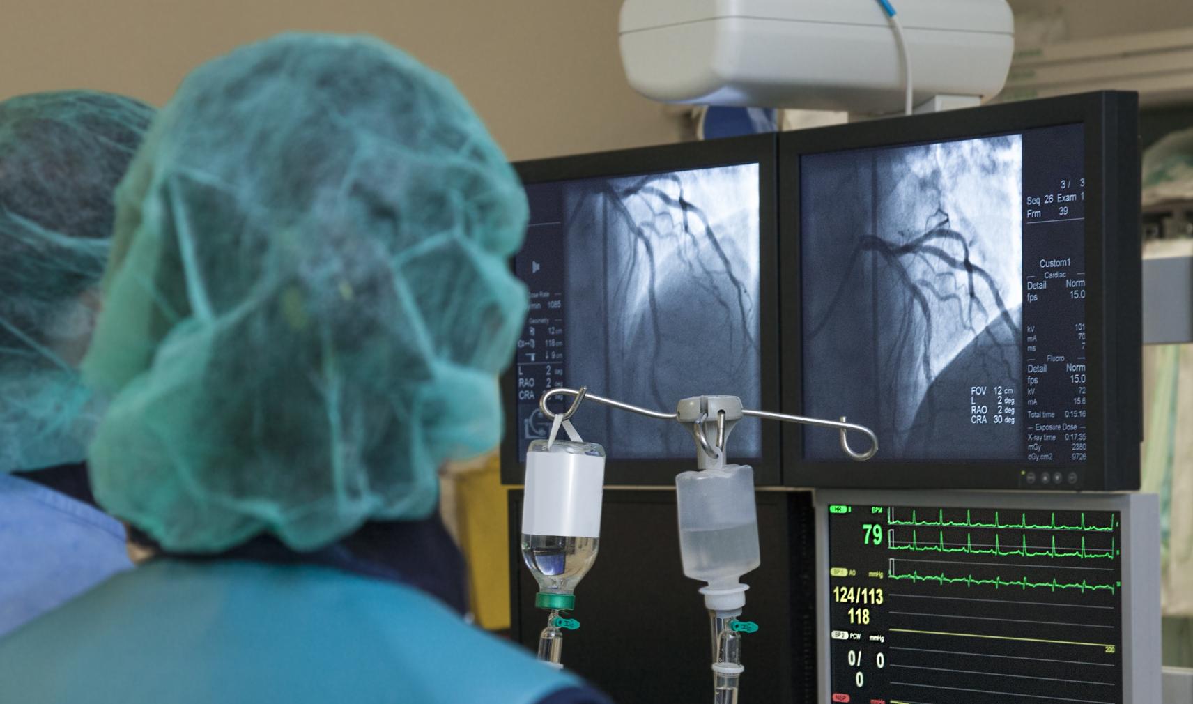 catheter cardiac surgery