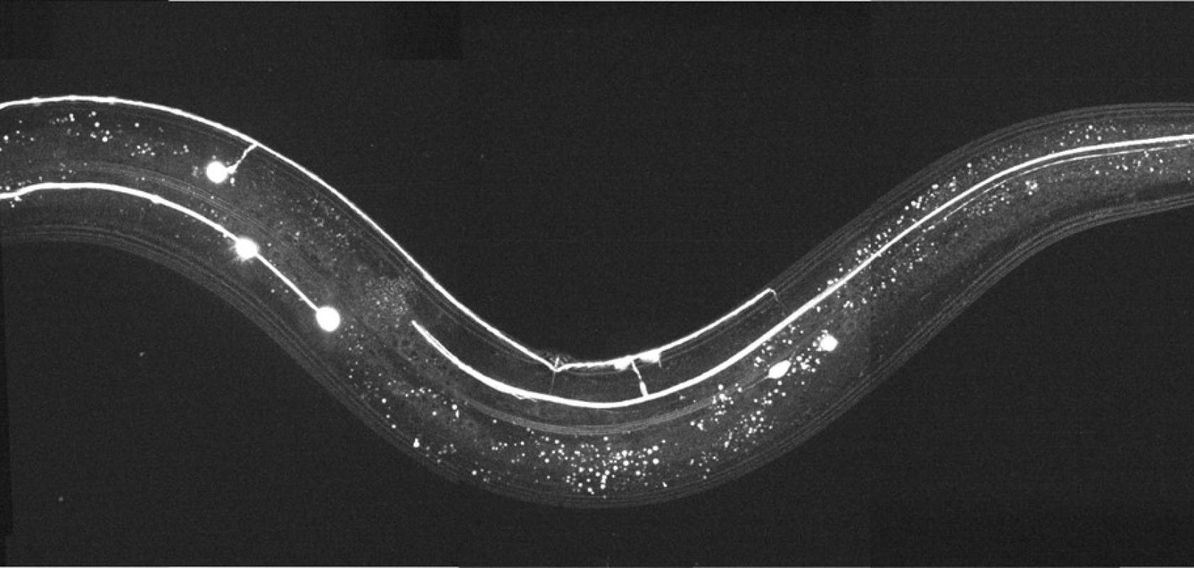 Caenorhabditis elegans