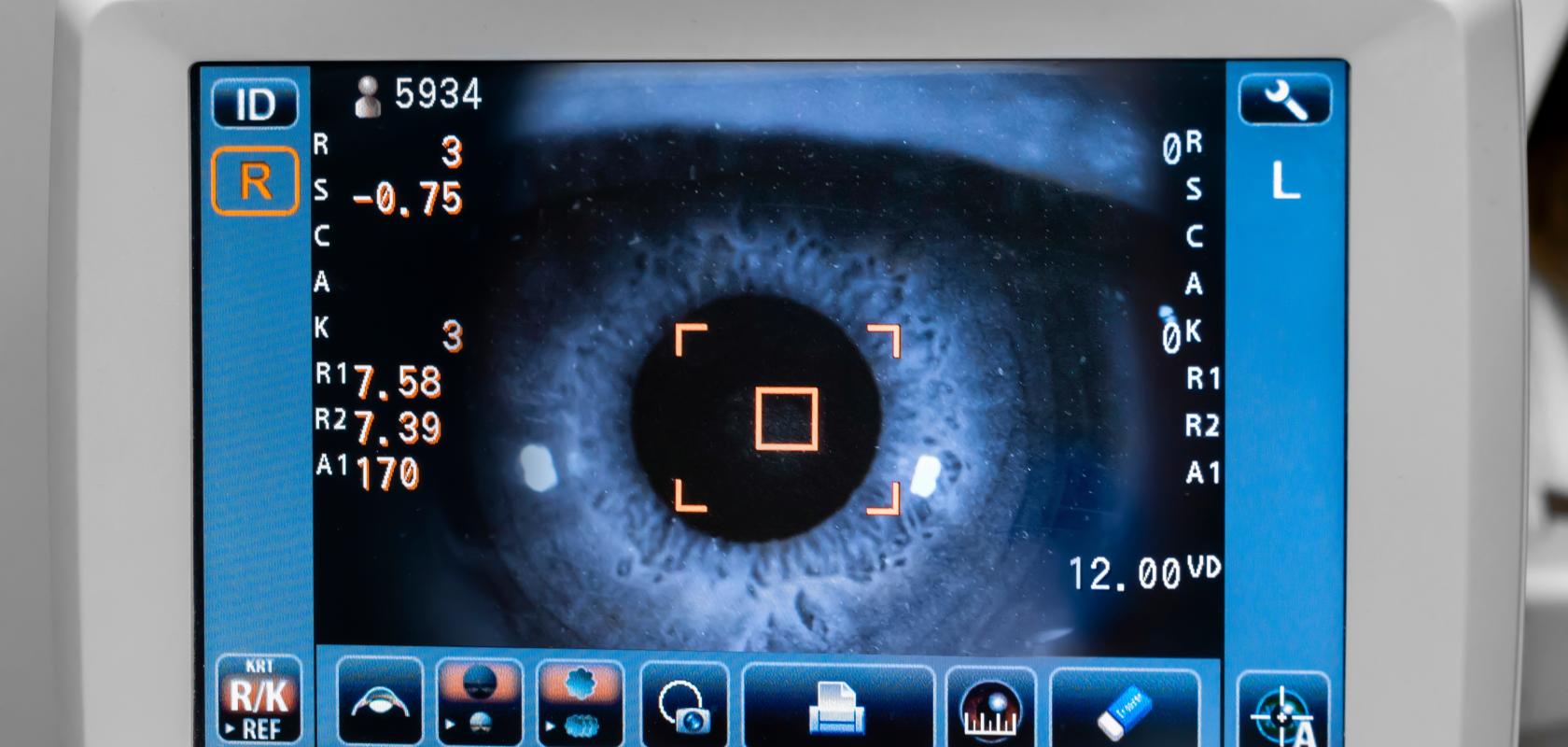 eye imaging