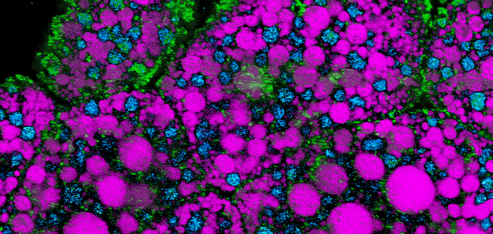 Fruit fly lipids