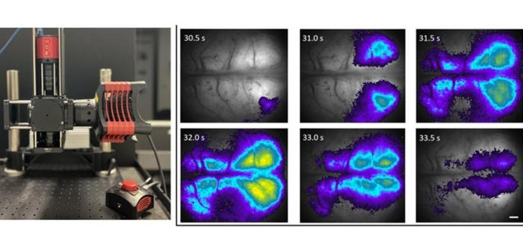 mesoscope low cost brain