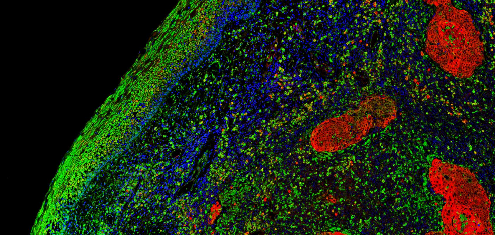 Fluorescence imaging can present a balancing act 