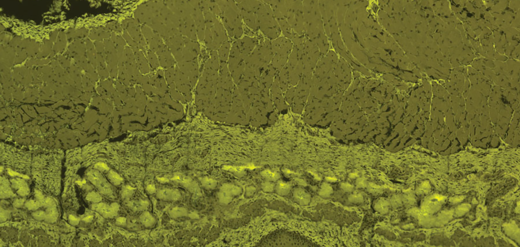 Fluorescent image of epithelial cell using Villuminator