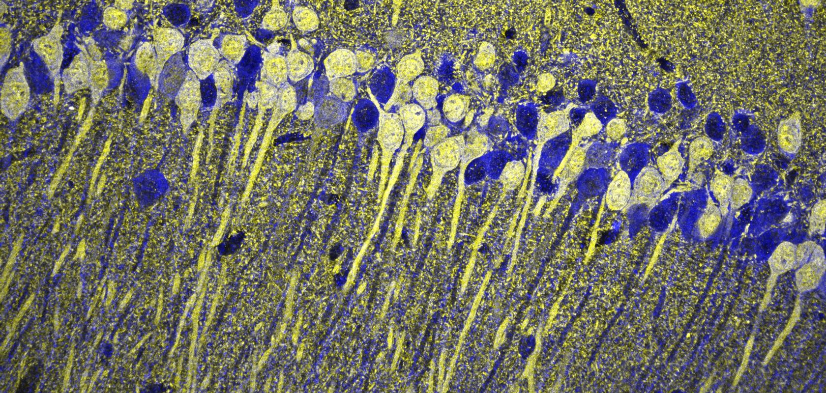 Image of a section of mouse hippocampus to illustrate this White Paper: How Oxxius MixxWave laser combiners power UCL's cancer research mesoSPIM for lightsheet brain imaging
