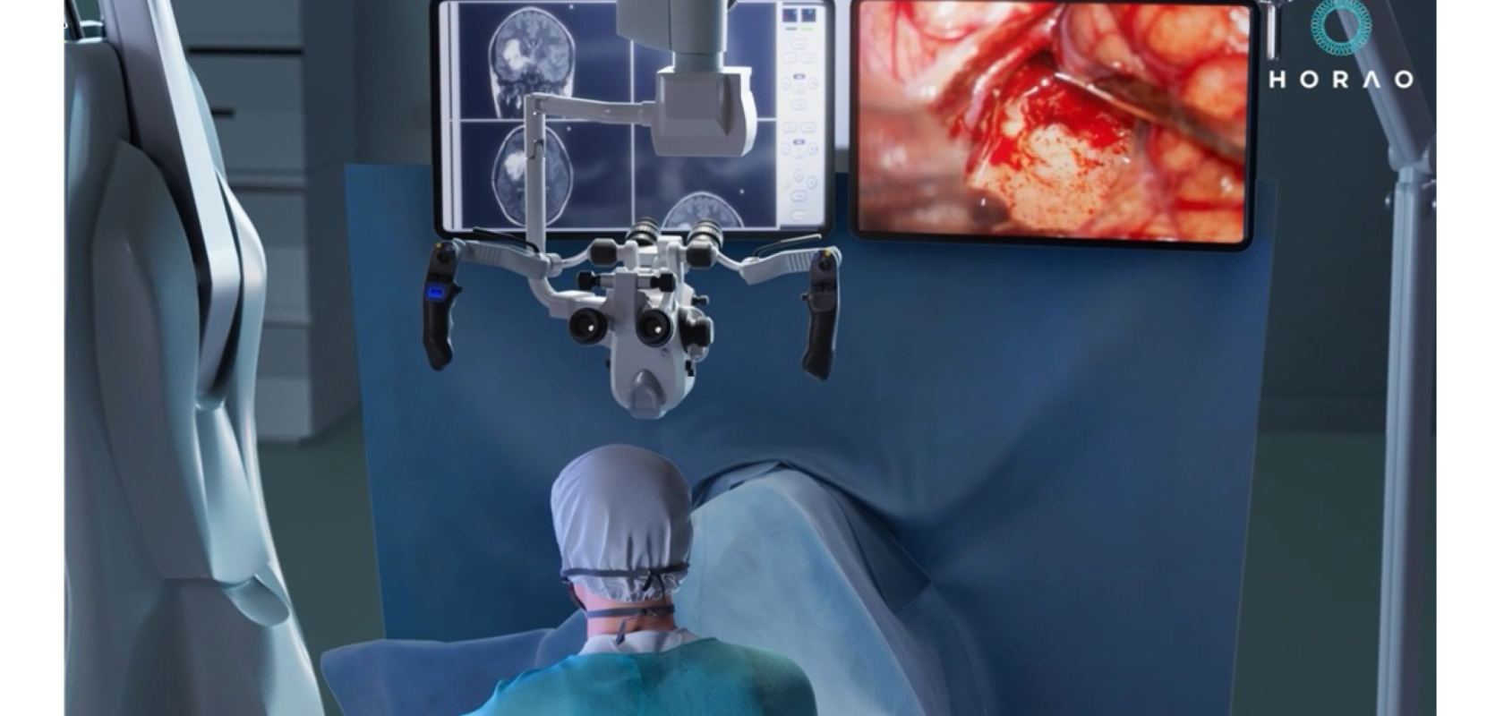 A surgeon, with their back to the camera, is carrying out brain surgery with the assistance of two screens showing polarimetric scans of the patient's brain tissue
