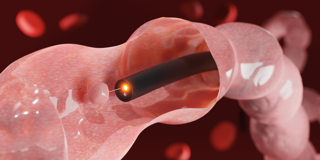 Endoscope