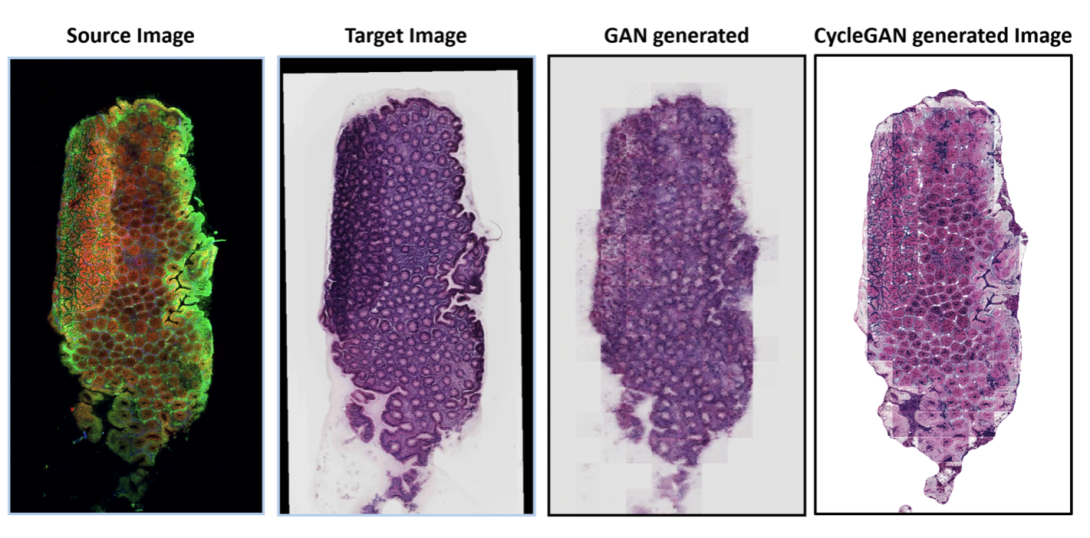 Results of GNN-based generation for computational staining