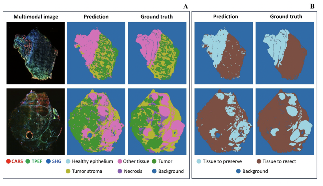 Results of CNN prediction for tissue classification